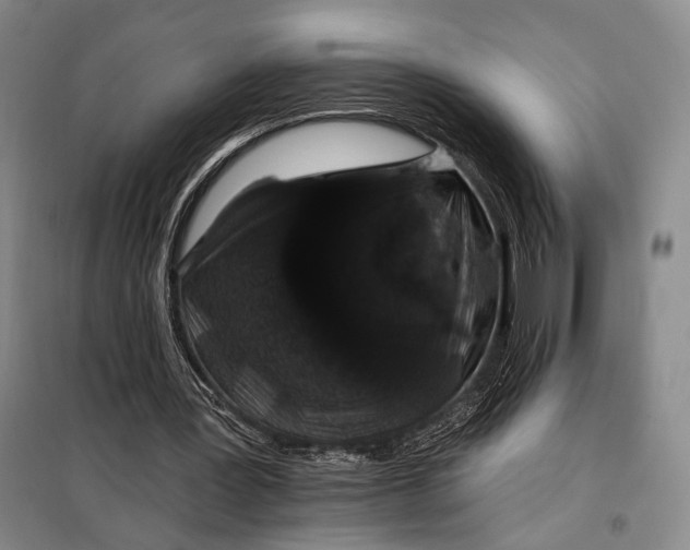 X0000098010387200804181141