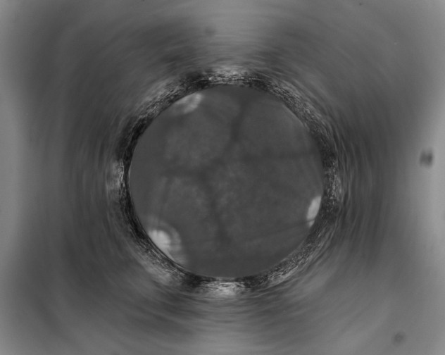 X0000098010711200804181135