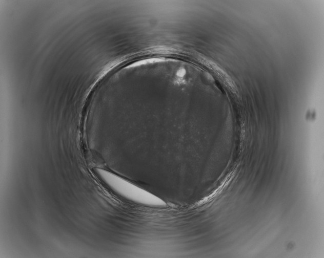 X0000098011170200804181127