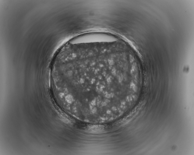 X0000098011171200804181127