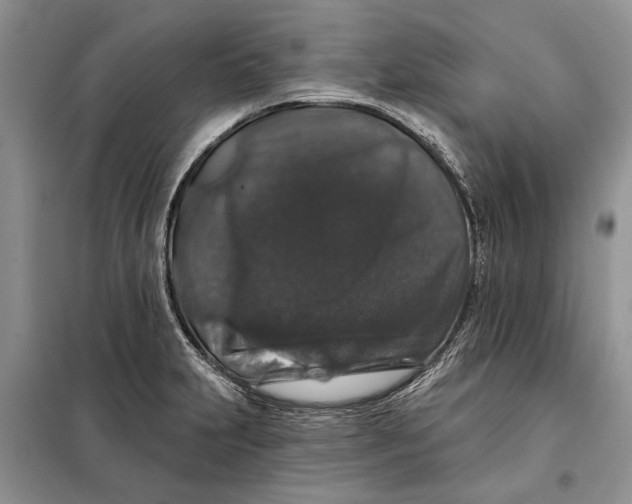 X0000098011231200804181126