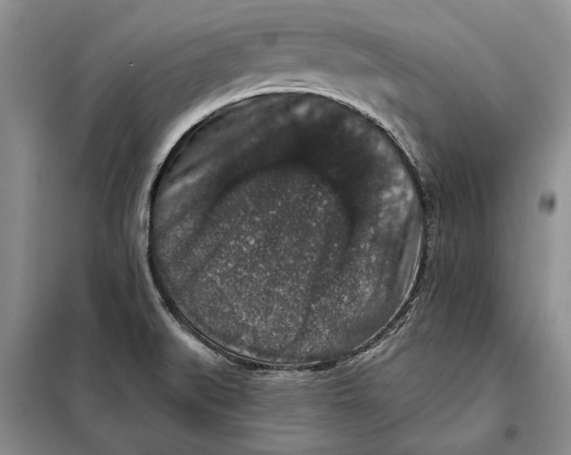 X0000098011519200804181121