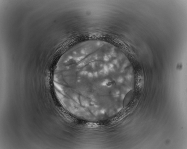 X0000098010519200804251117