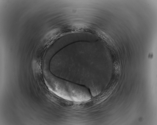 X0000098011060200804251109