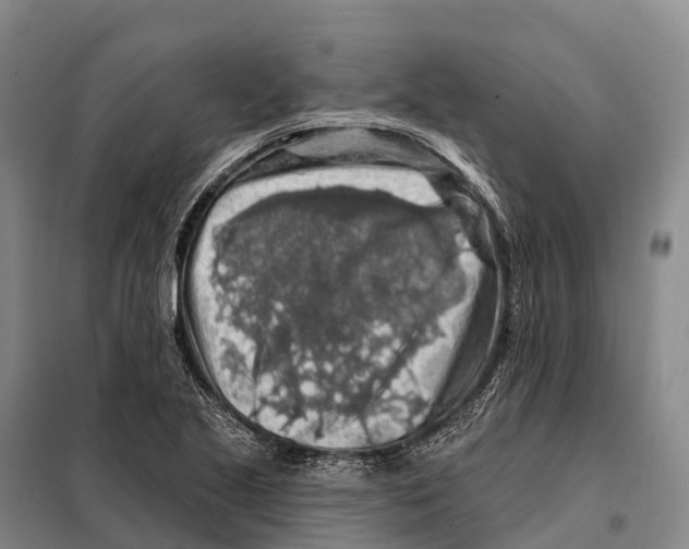 X0000098011221200804251107