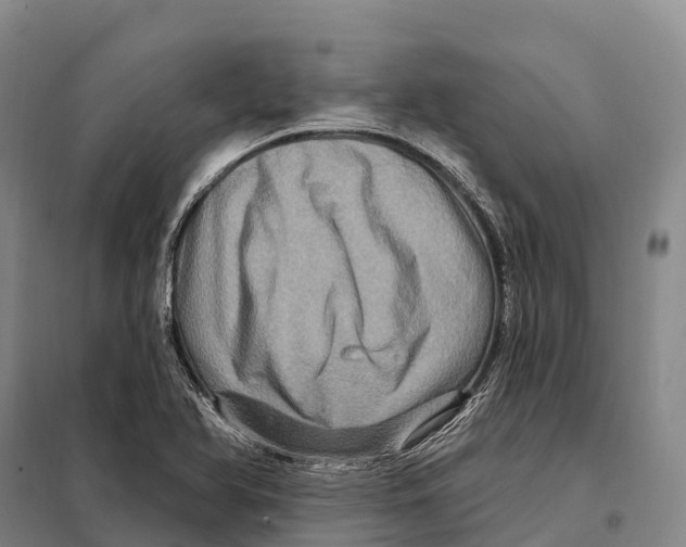 X0000098011366200804251105