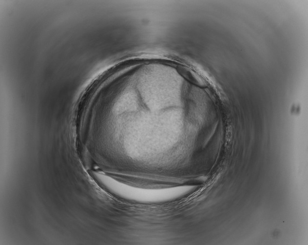 X0000098011456200804251103