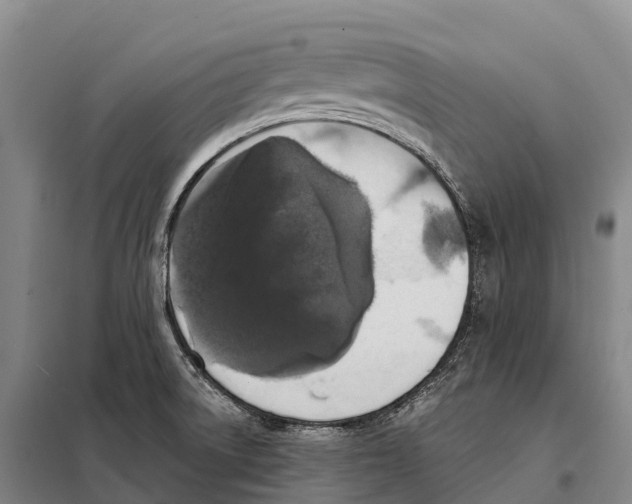 X0000098011522200804251103