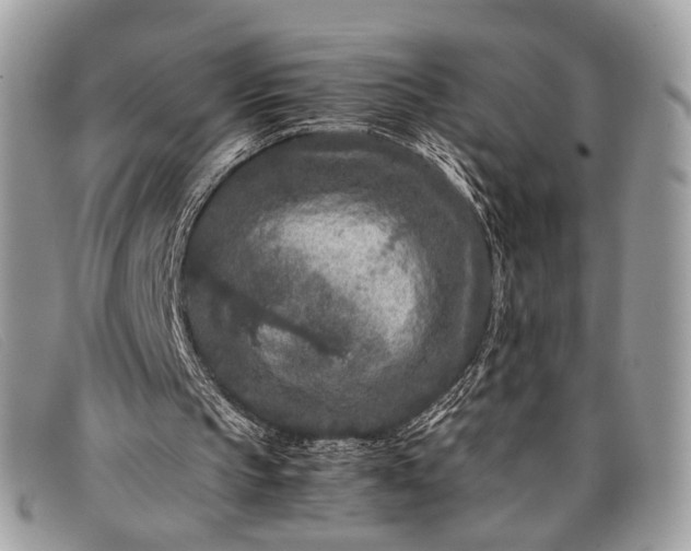 X0000098020145200804111306