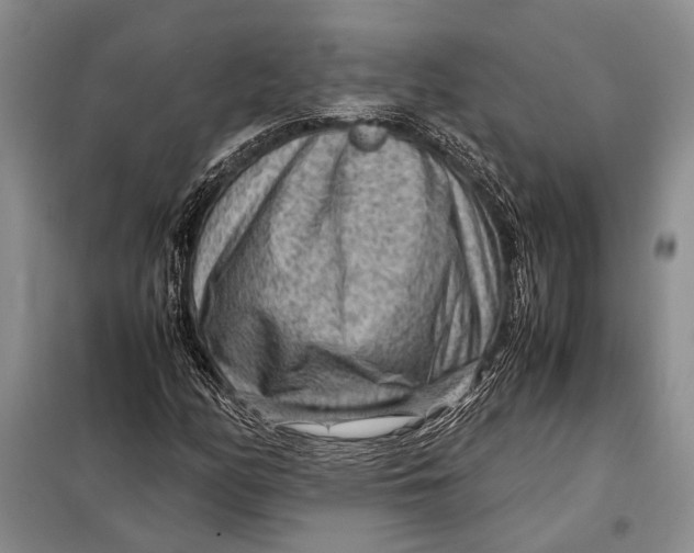 X0000098021158200804181155