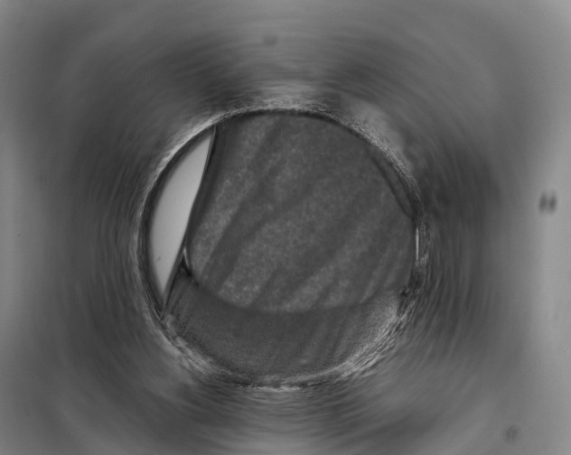 X0000098020156200804251145