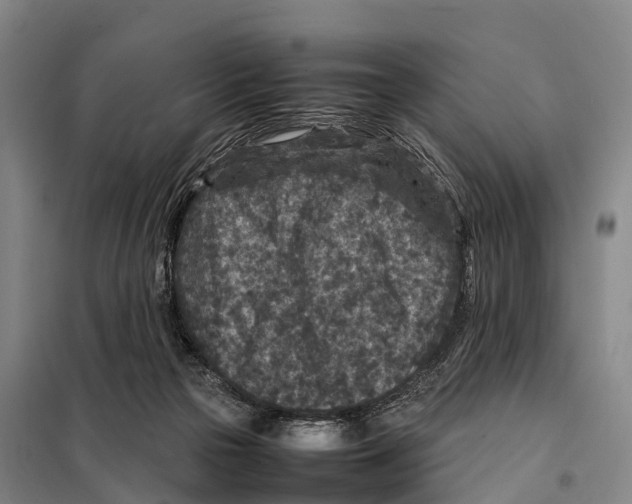 X0000098020169200804251145