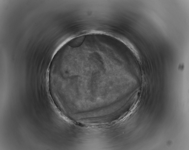 X0000098021198200804251130