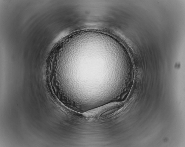 X0000098051411200804111301