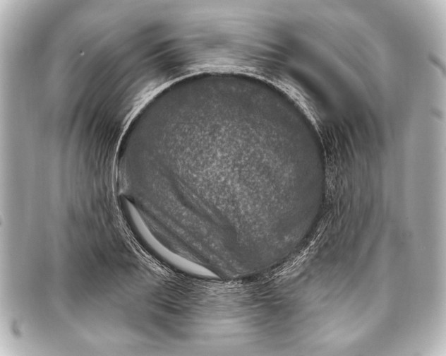 X0000098070887200804181130