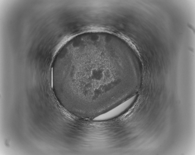 X0000098071175200804181125