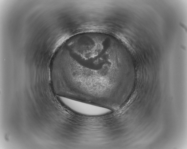 X0000098071267200804181123