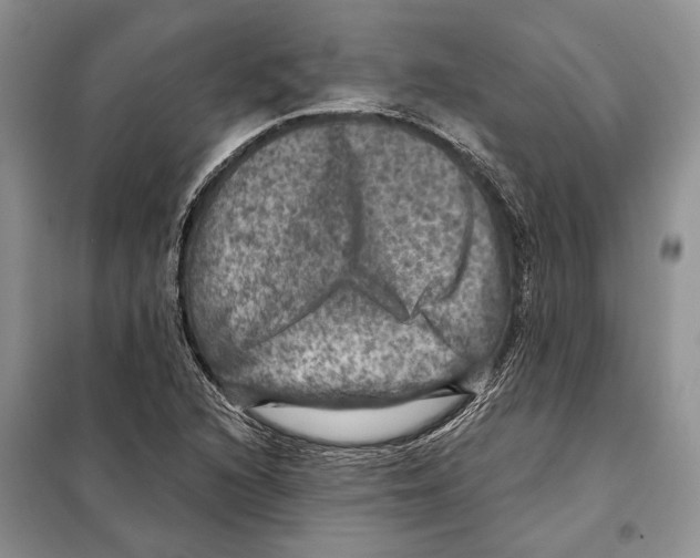 X0000098071216200805020949