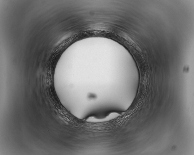 X0000098081014200805021017