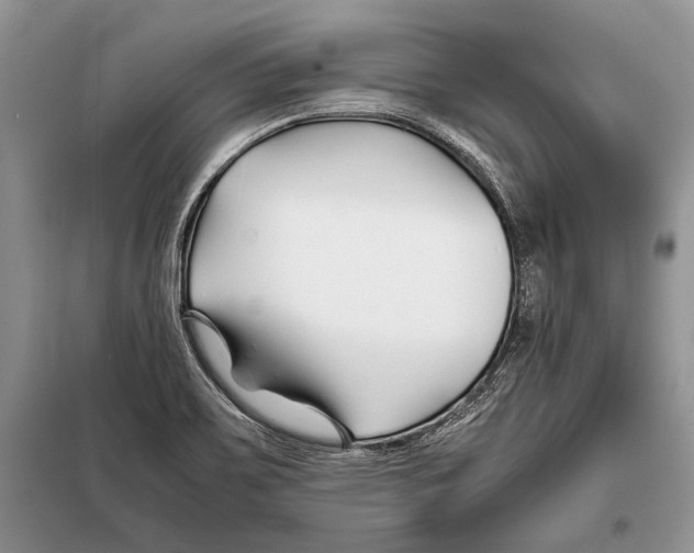 X0000098081467200805021010