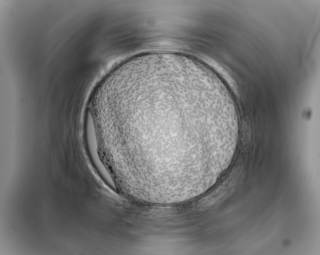 X0000098081477200805021010