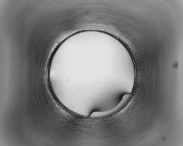 X0000098081517200805021009