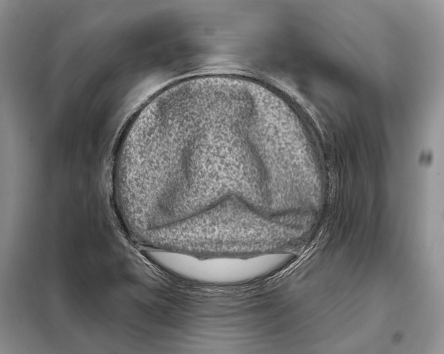 X0000098091415200805021035