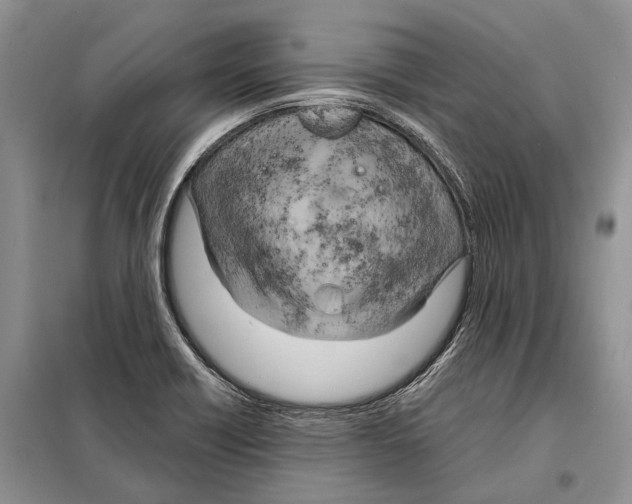 X0000098091418200805021035