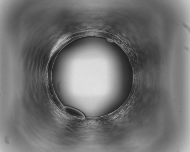 X0000098100198200804181434