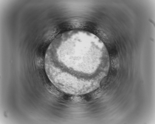X0000098100419200804181430