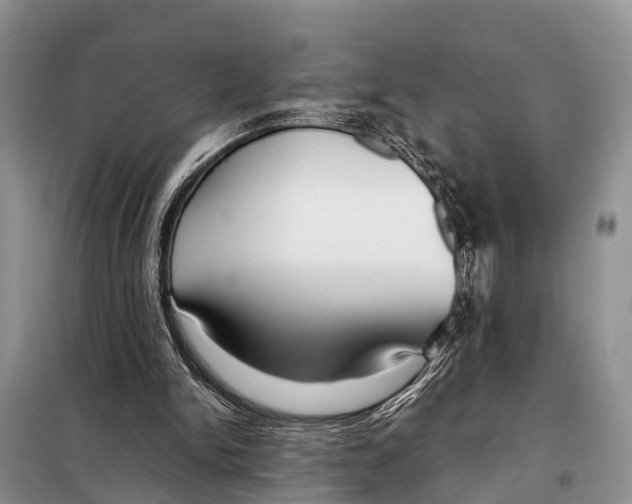 X0000098100150200805021118