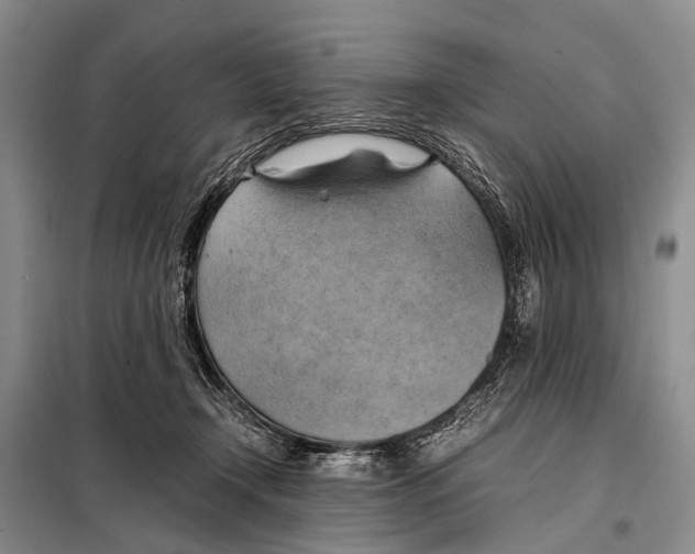 X0000098100366200805021115