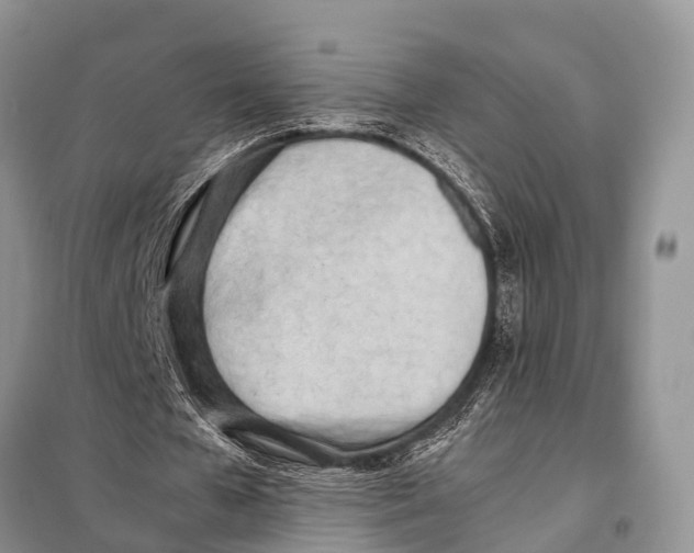 X0000098100577200805021112