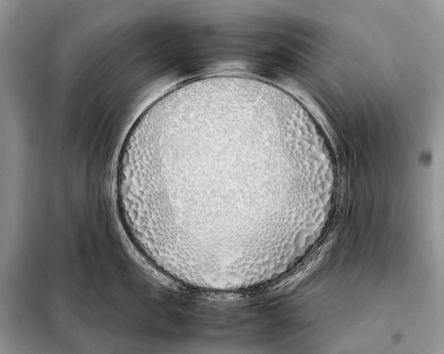 X0000098100957200805021106
