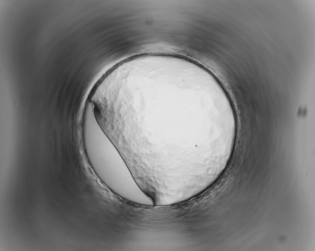 X0000098101008200805021105