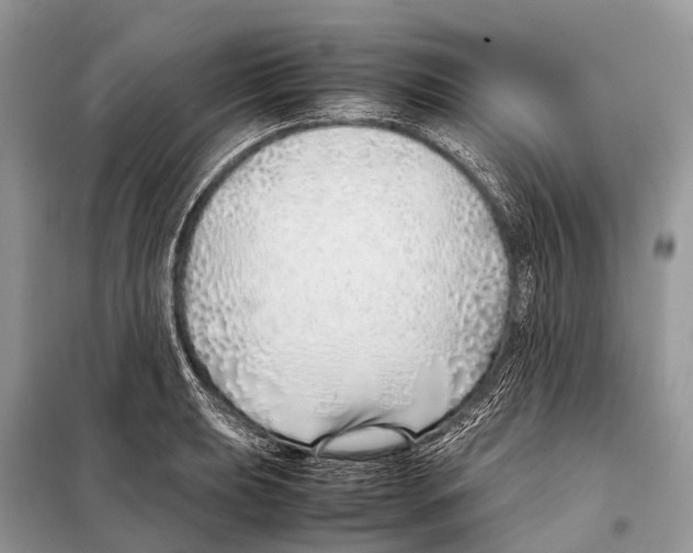 X0000098101039200805021105