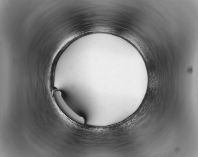 X0000098101139200805021103
