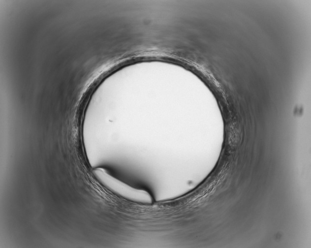 X0000098101167200805021103