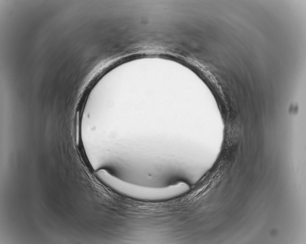 X0000098101175200805021102