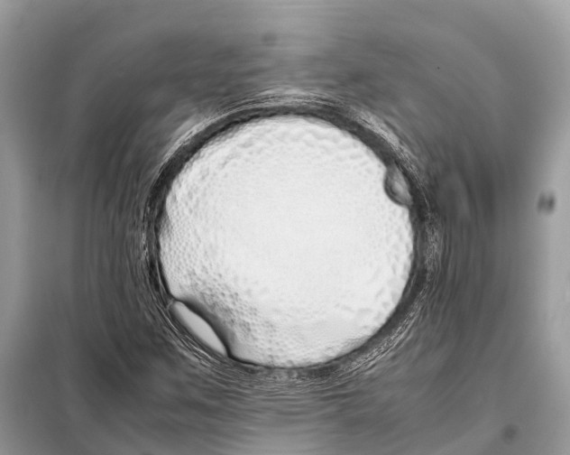 X0000098101259200805021101