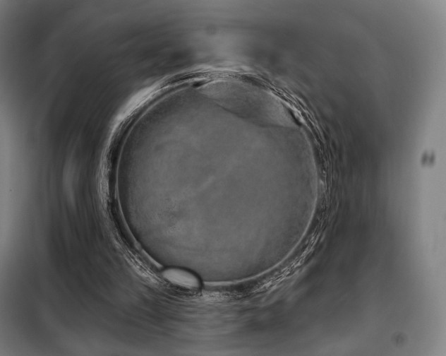 X0000098110149200804041352