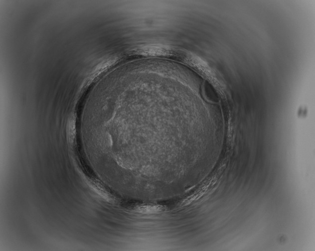 X0000098110202200804041352