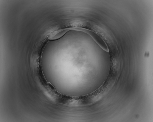X0000098110356200804041350