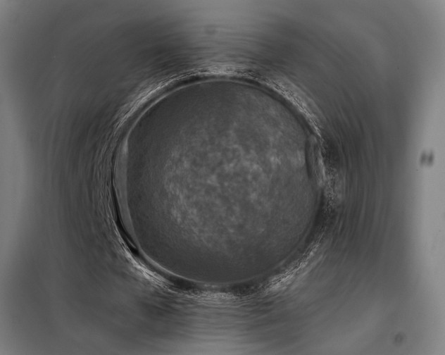 X0000098110577200804041346