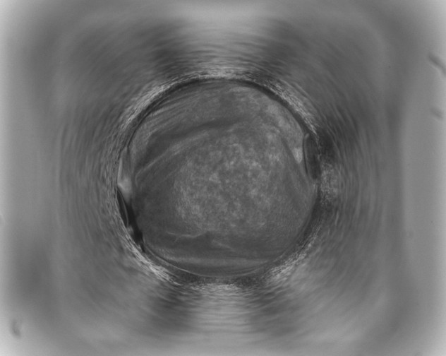 X0000098110577200804181454