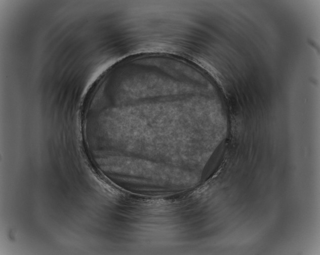 X0000098111120200804251421