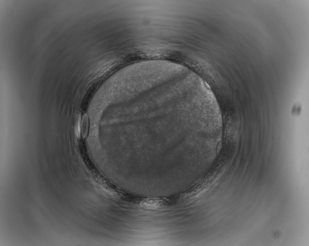 X0000098110076200805021143