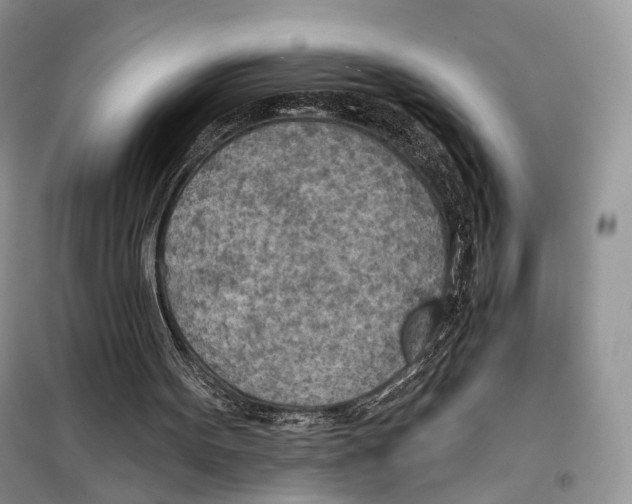 X0000098110099200805021142