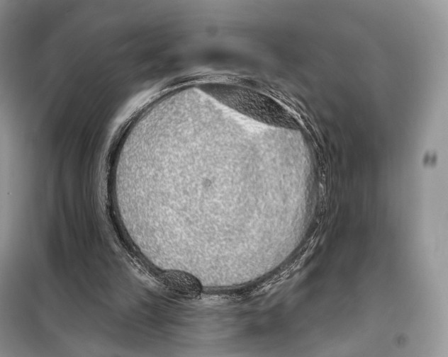 X0000098110149200805021141