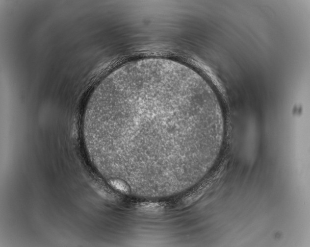 X0000098110161200805021141